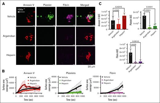 Thrombus formation is inhibited by argatroban (a thrombin inhibitor) and heparin in the Endo-chip laser-injury model. (A) Blood was incubated with vehicle, argatroban (0.5 μg/mL), or heparin (0.5 U/mL) for 10 minutes at RT. Blood was then labeled with annexin V, anti-CD41, and antifibrin antibody, recalcified with CaCl2 (10 mM), and then immediately perfused through the Endo-chip at 100 s–1, followed by laser pulse to the endothelial layer. Representative images of annexin V (red), platelet (CD41, green), and fibrin (magenta) accumulation at the injury site at 10 minutes. (B) Kinetics of annexin V (left panel), platelet (middle panel), and fibrin (right panel) over time in response to vehicle, argatroban, or heparin. (C) Annexin V (upper left panel), platelet (upper right panel), and fibrin (lower panel) AUC after treatment of blood with vehicle, argatroban, or heparin. Mean ± SD, n = 5 independent experiments, 1-way analysis of variance with Dunnett’s multiple comparisons test. AUC, area under the curve.