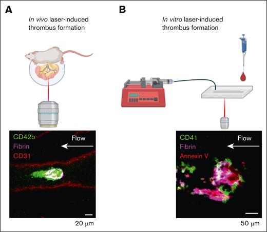 Ablation laser-injury models of thrombus formation. (A) In vivo laser-injury model performed by exteriorizing the mesenteric vein, or artery, and pulsing a high-powered laser. Representative image of platelet (CD42b, green) and fibrin (magenta) accumulation on mesenteric vein endothelium (CD31, red). (B) In vitro laser-injury model performed by pulsing a high-powered laser on the endothelialized surface of a microfluidic chip (Endo-chip). Representative image of platelet (CD41, green), fibrin (magenta), and annexin V (red).