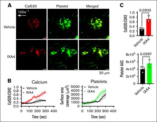 Induction of ER stress by IXA4 increases the mobilization of platelet calcium in the Endo-chip laser-injury model. (A) Blood was incubated with vehicle (dimethyl sulfoxide) or the inositol-requiring enzyme 1 activator IXA4 (300 μM) for 2 hours at RT. Blood was then labeled with the calcium dye Cal520 and anti-CD42a, recalcified with CaCl2 (10 mM), and then immediately perfused through the Endo-chip at 100 s–1, followed by a laser pulse to the endothelial layer. Representative images of calcium (red) and platelet (CD42a, red) accumulation at the injury site at 10 minutes. (B) Kinetics of calcium (left panel) and platelet (right panel) surface area coverage over time in response to vehicle or IXA4. (C) Calcium (upper panel) and platelet (lower panel) AUC after treatment of blood with vehicle or IXA4. Mean ± SD, n = 3 independent experiments, paired t test. AUC, area under the curve.