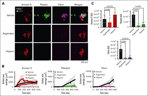Thrombus formation is inhibited by argatroban (a thrombin inhibitor) and heparin in the Endo-chip laser-injury model. (A) Blood was incubated with vehicle, argatroban (0.5 μg/mL), or heparin (0.5 U/mL) for 10 minutes at RT. Blood was then labeled with annexin V, anti-CD41, and antifibrin antibody, recalcified with CaCl2 (10 mM), and then immediately perfused through the Endo-chip at 100 s–1, followed by laser pulse to the endothelial layer. Representative images of annexin V (red), platelet (CD41, green), and fibrin (magenta) accumulation at the injury site at 10 minutes. (B) Kinetics of annexin V (left panel), platelet (middle panel), and fibrin (right panel) over time in response to vehicle, argatroban, or heparin. (C) Annexin V (upper left panel), platelet (upper right panel), and fibrin (lower panel) AUC after treatment of blood with vehicle, argatroban, or heparin. Mean ± SD, n = 5 independent experiments, 1-way analysis of variance with Dunnett’s multiple comparisons test. AUC, area under the curve.