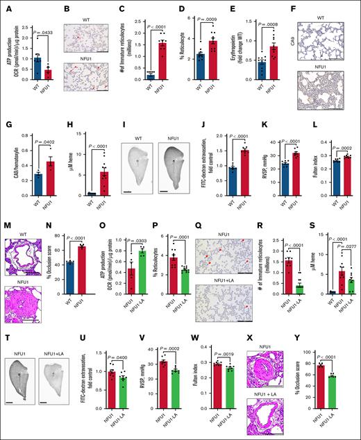The role of mitochondrial dysfunction in reticulocytes and hemolysis. (A) ATP production: mitochondrial ATP production, as measured by the Seahorse XF assay, is significantly decreased in NFU1 reticulocytes. ATP production is measured as the difference in the OCR after the addition of oligomycin, a complex V inhibitor (n = 5-7). (B-C) Immature reticulocytes: the number of immature reticulocytes, identified by the persistence of mitochondria under microscopy, is markedly increased in the blood of NFU1 rats. Scale bar, 50 μm (n = 8). (D) Circulating reticulocytes: reticulocyte counts are significantly elevated in NFU1 rats, indicating increased production, decreased clearance, and maturation of reticulocytes (n = 10). (E) EPO levels: EPO levels, which control reticulocyte and RBC production, determined by enzyme-linked immunosorbent assay are significantly elevated in the plasma of NFU1 rats (n = 10). (F-G) Carbonic anhydrase 9 (CA9) expression: immunohistochemical staining shows increased CA9 expression in the lungs of NFU1 rats, indicating a potential hypoxic environment. Scale bar, 200 μm (n = 4). (H) Circulating free heme: free heme levels in the plasma are significantly elevated in NFU1 rats, indicating hemolysis (n = 10). (I-J) Barrier disruption: FITC-dextran extravasation assays reveal significant barrier disruption in the lungs of NFU1 rats. Scale bar, 5 mm (n = 7-8). (K) RVSP: RVSP is significantly increased in NFU1 rats, indicating significant PH (n = 8). (L) Fulton index: the Fulton index, indicative of right ventricular remodeling (calculated as follows: right ventricle/left ventricle + septum), is significantly elevated in NFU1 rats (n = 8). (M-N) Vascular occlusion score: the vascular occlusion score, a measure of vascular remodeling, is markedly increased in NFU1 lungs. Scale bar, 100 μm (n = 5). (O) LA treatment: LA supplementation in NFU1 rats significantly improves mitochondrial ATP production (n = 5). LA is a cofactor of PDH, a mitochondrial enzyme. LAS synthesizes LA. The NFU1 protein inserts Fe-S clusters in LAS, enabling LA synthesis. The NFU1 mutation impairs LA synthesis because of LAS dysfunction. LA supplementation directly circumvents the LAS dysfunction. (P) Reticulocyte count posttreatment: reticulocyte numbers are normalized in NFU1 rats after LA treatment (n = 10-12). (Q-R) Immature reticulocytes posttreatment: LA treatment significantly reduces the number of immature reticulocytes in NFU1 rats, indicating improved reticulocyte maturation (n = 10-12). (S) Free heme posttreatment: free heme levels are significantly reduced in NFU1 rats after LA treatment, indicating decreased hemolysis (n = 9-10). (T-U) Barrier protection posttreatment: LA treatment significantly protects NFU1 rats from barrier disruption, as shown by reduced FITC-dextran extravasation in the lungs. Scale bar, 10 mm (n = 8). (V) RVSP posttreatment: LA treatment significantly protects NFU1 rats from increased RVSP, indicating a protection from the induction of PH (n = 8). (W) Fulton index posttreatment: LA treatment prevents the rise in the Fulton index in NFU1 rats (n = 8). (X-Y) Vascular remodeling posttreatment: LA treatment in NFU1 rats significantly reverses pulmonary vascular remodeling. Scale bar, 100 μm (n = 5-6). For panels A-R, a P value of <.05 was considered significant as determined by an unpaired t test. For panel S, significance was determined using 1-way analysis of variance with selected comparisons between NFU1 vs NFU1-LA and NFU1 vs wild-type (WT) groups, followed by a Holm-Sidak post hoc test. (T-Y) used an unpaired t test to determine significance, with a P value of < .05 considered significant. ATP, adenosine triphosphate; FITC, fluorescein isothiocyanate; OCR, oxygen consumption rate.