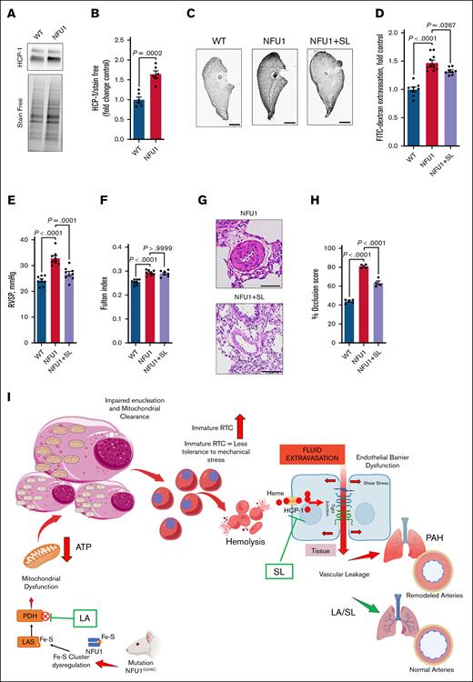 Attenuation of heme in hemolysis-induced PH. (A-B) HCP1 expression: HCP1 expression is significantly increased in NFU1 rat lungs, indicating an increased availability of free heme to vascular cells (n = 6). (C-D) Barrier dysfunction: FITC-dextran extravasation is markedly increased in the lungs of NFU1 rats, indicating barrier dysfunction. Using an HCP-1 inhibitor, sulfasalazine (SL) in NFU1 rats significantly decreased FITC-dextran extravasation, indicating that preventing the cellular entry of free heme attenuates barrier dysfunction. Scale bar, 10 mm (n = 8-10). (E) RVSP: RVSP is significantly elevated in NFU1 rats and is attenuated after SL treatment, showing that controlling free heme entry can attenuate PH (n = 8). (F) Fulton index: the elevated Fulton index observed in NFU1 rats is not significantly reduced by SL treatment (n = 7-8). (G-H) Vascular remodeling: severe vascular remodeling in NFU1 rats is significantly reversed by SL treatment. Scale bar, 100 μm (n = 4-5). (I) Schematic overview: this illustrates how MD, leading to reduced ATP levels, impairs the clearance of nuclei and organelles in RTC, increasing their susceptibility to stress and subsequent hemolysis. The resulting free heme entry into cells contributes to barrier dysfunction, vascular leakage, and pulmonary arterial hypertension (PAH). LA supplementation improves mitochondrial function, enhances reticulocyte maturation, and prevents hemolysis. SL treatment blocks heme entry, mitigating barrier dysfunction and PAH progression. A significance level of P < .05 was considered for all comparisons. An unpaired t test was used for panel A, whereas a 1-way analysis of variance of selected columns (WT vs NFU1 and NFU1 vs SL) followed by Bonferroni post hoc test was applied for panels C-H. ATP, adenosine triphosphate; FITC, fluorescein isothiocyanate; RTC, reticulocytes.