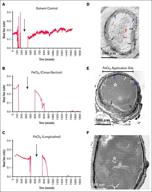 Examples of blood flow monitoring and corresponding artery structure. Comparison between blood flow (A-C) and morphology of murine femoral perpendicular cross-sections (C,E) and longitudinal section (F, parallel to flow from deionized water; A, solvent control; B-C, FeCl3-treated mice). Both cross-sections were from the middle of the FeCl3 application area. (A) Mock-treated sample showing underlying intima (pale, low staining circumferential ring). Blue arrows indicate the folded smooth muscle layer, and red arrows indicate RBC inside the arterial lumen. The inset is zoomed out in Figure 3A. (B) The upper bar marks the FeCl3 application site. White arrows point to flattened endothelial layer indicative of vascular damage; black arrows point to normal corrugated/folded endothelial layer; and blue arrows point to the smooth muscle layer. The arterial lumen itself is filled by a platelet-rich clot. The insets are zoomed out in panels B, C, and D, respectively. (C) Blood flow in the femoral artery was monitored and measured with a transit-time perivascular flowmeter and sonic probe. Arrows indicate the timing of the mock treatment. The initial segment was the flow signal detected before the mock treatment. The flow probe signal dropped out as fluid in the vessel’s surroundings was removed to prevent mock dilution. Fluid was reintroduced upon removal of the mock filter paper, and the flow probe again became functional. Following mock application, ∼20 minutes of probe flow signal data were collected. No dip in flow signal following treatment indicates no occlusion. (D) In this instance, FeCl3 was used instead of deionized water. A complete cessation of the blood flow signal with FeCl3 treatment indicates an occlusive clot. At this image zoom, the pockets of loosely adherent platelets are most obvious in the longitudinally section sample in panel F.