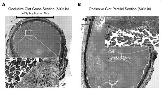 Detailed imaging of polyhedral RBCs and surrounding platelets. Higher zoom of perpendicularly (A) and longitudinally (B) sectioned occlusive clot showing the appearance of entrapped, polyhedral RBCs.