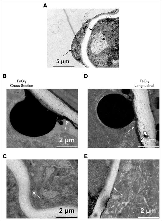 High zoom imaging of the intimal layer of deionized water (solvent control) and an FeCl3-treated example. (A) Reference imaging of the mock-treated sample showing normal endothelial cells lining the vessel lumen. (B) FeCl3-treated femoral artery showing adherence of platelets to blackened endothelial cell layer. (C) Zoomed image showing attachment of platelets to a relaxed area of the endothelial intima layer, indicating minimal damage. (D) Zoomed imaging from FeCl3-treated sample showing platelet adherence to endothelial layer of corrugated intima. Arrows point to thin endothelial cell continuities along the underlying elastin-rich intima.