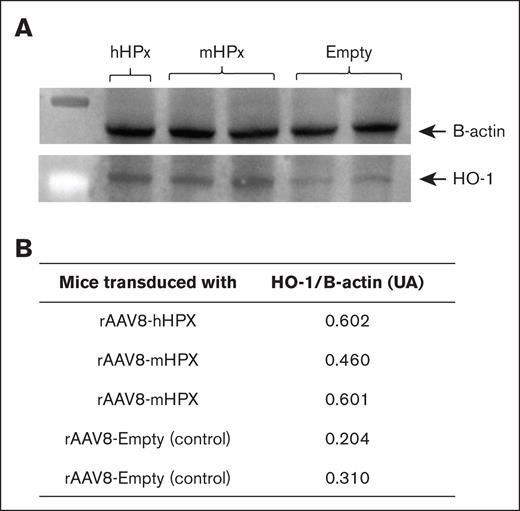 Western blot analysis of HO-1 expression in the liver of C57Bl/6J mice transduced with 1 × 1014 vg/kg rAAV8-hHPX or rAAV8-mHPX vector and challenged with 70 μM/kg of heme. Samples were obtained 1 hour after infusion. (A) Lower protein expression is demonstrated in gels and expressed as AUs (B) after densitometry.