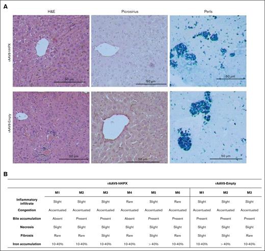 Liver histology. (A) Representative images of H&E stained liver sections from Townes mice treated with rAAV8-hHPX or control (rAAV8-Empty) vectors. No evidence of inflammation, fibrosis, or necrosis were observed. Original magnification ×400. (B) Results from individual mice; n = 3 to 6 per group. Analysis performed by 2 blinded observers. Single-cell necrosis denotes sparse and rare events. H&E, hematoxylin and eosin; M, mouse.