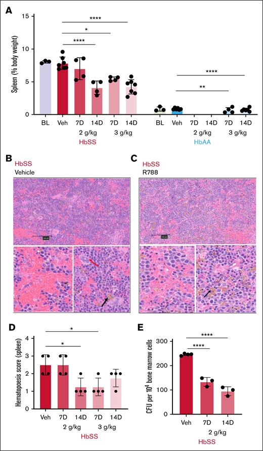 Effects of R788 treatment on extramedullary hematopoiesis. (A) Impact of R788 treatment on spleen weights expressed as percentage body weight in HbSS and HbAA mice after treatment with R788 at 2 g/kg and 3 g/kg for 7 and 14 days (gaps represent missing/not available data). (B) Representative low magnification (scale bar, 100 μm) cross-section image of hematoxylin and eosin (H&E)–stained splenic sections from vehicle-treated HbSS mouse and (below) under high magnification (scale bar, 10 μm) shows splenic engorgement and foci of hematopoietic cells (red arrow, evaluated on the basis of extent of megakaryocytes present) representing extramedullary hematopoiesis. (C) H&E-stained splenic sections of R788-treated (3 g/kg for 14 days) HbSS mice at low magnification, and at high magnification (below) showing reduction in splenic engorgement, reduced hematopoietic foci, and increased iron pigment deposition (black arrow). (D) Splenic hematopoietic score (erythroid precursor colonies with megakaryocytes: 0, absent; 1, mild; 2, moderate; 3, severe; and 4, abundant) after vehicle or R788 treatment in HbSS mice. (E) CFU count from 104 cultured BM cells in methylcellulose-based Media (MethoCult GF M3434) from vehicle- and R788-treated (2 g/kg for 7 and 14 days) HbSS mice. Data are presented as mean ± standard deviation (SD), with each data point representing a single animal. Statistical comparisons between treatment groups and the vehicle group were performed using 1-way ANOVA followed by the Dunnett test, or 2-way ANOVA with false discovery rate (FDR) correction for multiple comparisons. Significance set as follows: ∗P < .05; ∗∗P < .01; ∗∗∗P < .001; ∗∗∗∗P < .0001. HbSS, red; HbAA, blue. BL, baseline; Veh, vehicle-treated.