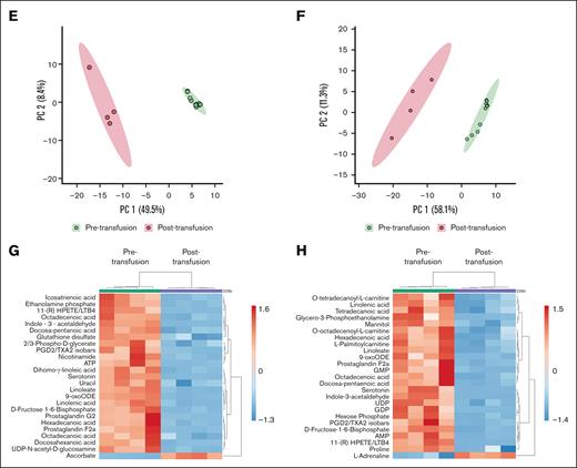 Metabolism changes from pretransfuion to posttransfusion in murine platelets. (A) Visual outline of the study. (B) Heat maps of metabolites (mean-centered and divided by the standard deviation of each variable) of platelet-rich plasma (CSP, left panel; RTP, right panel) after storage (pretransfusion, left) and after transfusion into thrombocytopenic animals (posttransfusion, right). Metabolite groups are color-coded to correspond with volcano plots in (C-D). (C-D) Volcano plots of CSP (C) and RTP (D), with the colors of the dots corresponding to the metabolite groups in the heat maps. Dots above the dashed line are below the FDR significance cutoff of q = 0.05, following the Benjamini-Hochberg procedure for P values derived from a 2-tailed, unpaired Student t test. Principal component analyses for CSPs (E) and RTPs (F). (G) Heat maps of the top 25 clustered metabolites in CSP with posttransfusion values averaged between recipients of the same donor. (H) Heat maps of the top 25 clustered metabolites in RTP with posttransfusion values averaged between recipients of the same donor. AS, amino sugars; FDR, false discovery rate; GPL, glycerophospholipid synthesis; LC-MS/MS, liquid chromatography–tandem mass spectrometry; PPP, pentose phosphate pathway; TCA, tricarboxylic acid cycle.