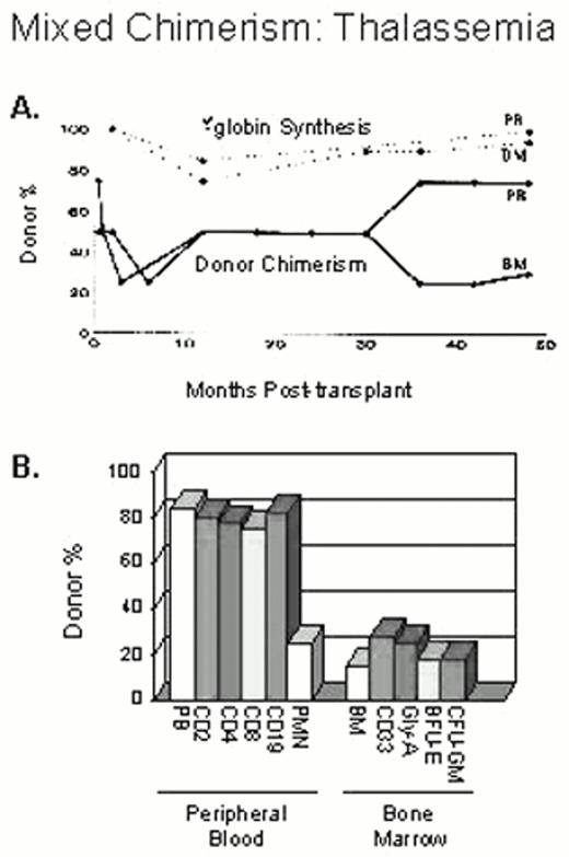 Figure 2. Donor-recipient origin of different peripheral blood and marrow cell populations at 4 years after transplantation. . / The percentage of donor chimerism in the blood and marrow nucleated cells is shown in A. β-globin chain synthesis by marrow and reticulocytes was greater than 90% at 4 years after transplant. Although there is an enrichment for donor cells in the mature red blood cell compartment as demonstrated by the high rate of β-globin synthesis, the percentage of donor cells in the immature red blood cell compartment (BFU-E and glycophorin-A positive cells) was approximately 20% (in B).