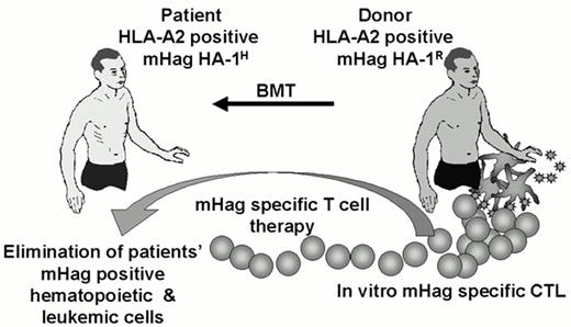 Figure 4. Adoptive immunotherapy of relapsed leukemia with CTLs specific for hematopoietic system-restricted mHags.