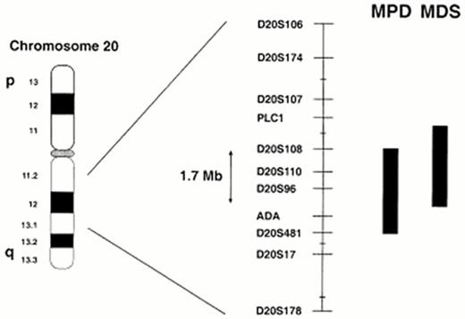 Figure 1. Summary of the common deleted region on 20q for MPD and MDS. Data taken from references 25 and 26.