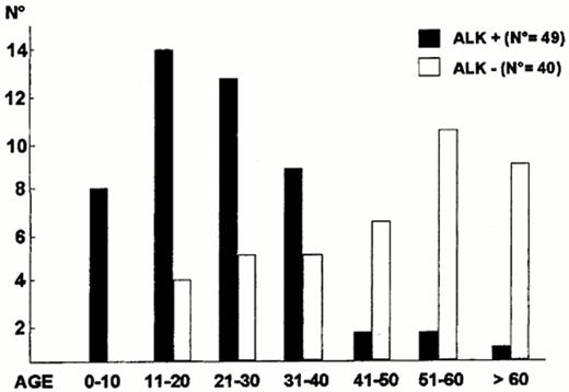 Figure 8. The different age distribution (years) of ALK+ anaplastic large cell lymphoma (ALCL) and ALK- ALCL.13