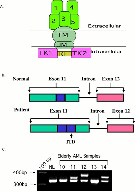 Radich Figure 5 (Appelbaum et al). Flt3 internal tandem duplication (ITD). / 2A. The structure of normal Flt3. The ITD occurs in the juxta-membrane region (JM). / 2B. A Cartoon of the FLT3/ITD. A 20-200 bp region from exon 11-12 (blue box) is duplicated and inserted in a head-to-tail fashion. / 2C. PCR of AML samples. Amplification of wild type Flt3 yields a 320 bp PCR amplimer. The higher bands in sample 11, 12, and 14 are Flt3/ITDs.