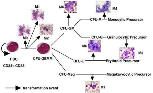Dick Figure 7 (Appelbaum et al). A model of AML heterogeneity that postulates leukemogenic events occurring in cells at different stages of lineage commitment.