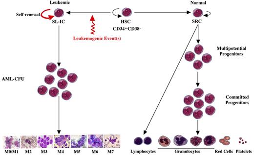 Dick Figure 8 (Appelbaum et al). A model of AML heterogeneity that postulates leukemogenic events occurring in primitive stem cells resulting in increased self-renewal, abrogation of normal differentiation, and the creation of a leukemic stem cell that originates a leukemic hierarchy.