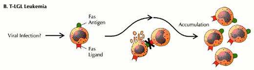 Loughran Figure 6 (Greer et al). Defects in programmed call death (apoptosis) have been suggested as the cause of lymphoproliferation in T-LGL leukemia. / Normally, viral infection of a target cell leads to upregulation of the Fas antigen (receptor) on the cell surface, while antigen recognition of viral peptide causes upregulation of Fas ligand on cytotoxic T lymphocytes (CTL) (A). Binding of Fas ligand to Fas receptor results in death of the viral-infected target cell. The cytotoxic T lymphocyte then upregulates Fas antigen and is itself killed by the effects of Fas binding. Viral infection has been hypothesized as an initial stimulus for LGL leukemia (B). Since LGLs are cytotoxic T lymphocytes, they express both Fas antigen and Fas ligand. In this case, activation of the Fas antigen-Fas ligand pathway is defective. The LGLs do not undergo apoptosis. Instead, leukemic LGLs accumulate in the blood.
