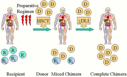Champlin Figure 8 (Storb et al). Scheme for nonablative hematopoietic transplantation for hematologic malignancy. / Recipients (R) receive a nonmyeloablative preparative regimen designed to achieve engraftment of an allogeneic hematopoietic cell transplant (HSCT). A short course immunosuppressive treatment is given to prevent GVHD. Initially mixed chimerism is present with coexistence of donor (D) cells with recipient-derived normal (R) and leukemia/lymphoma (RL) cells. Recipient and donor patterns of restriction fragment length polymorphisms are shown. Donor-derived T-cells act to eradicate residual recipient-derived normal and malignant hematopoietic cells leading to complete chimerism and remission. Donor lymphocyte infusions (DLI) may be administered to enhance graft-versus-malignancy effects.