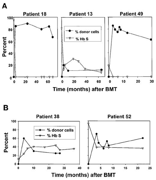 Figure 5. Serial determinations of donor chimerism and HbS fractions after transplantation. / (A) The fraction of donor cells in the blood (closed circles) and HbS fraction (open triangles) are depicted for 3 patients who had HbAA donors.(B) The fraction of donor cells and HbS in the blood are depicted for 2 patients who had HbAS donors.11. / Abbreviations: BMT, bone marrow transplantation. / Reprinted with permission from the American Society for Blood and Marrow Transplantation. Walters MC, Patience M, Leisening W, et al. Stable mixed hematopoietic chimerism after bone marrow transplantation for sickle cell anemia. Biol Blood Marrow Transplant. 2001;7:665–673.