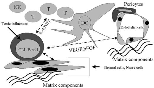 Figure 5. The maintenance and expansion of the malignant B-cell chronic lymphocytic leukemia (B-CLL) clone is primarily related to the genetic events induced by various inherited or environmental processes that lead to transformation. However, the overall process of leukemic B-cell clone survivorship is also linked to a complex circuitry of cytokines and chemokines that act in both autocrine and paracrine pathways. Importantly, stromal cells, dendritic cells, endothelial cells, nurse cells, and various immune cells contribute to this cytokine/chemokine array, which ultimately contributes to the behavior of the CLL B cell. Apparent physical association of the leukemic CLL B cell with these various cell types suggests that there is significant cellular crosstalk that assists in the induction of a microenvironment favorable to the leukemic CLL B cell.