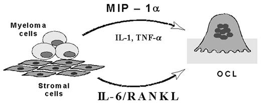 Figure 4. Regulation of osteoclast formation in myeloma. / Marrow stromal cells bind myeloma cells and induce production of IL-6, RANK ligand, and TNF-α. In addition, myeloma cells produce MIP-1α, IL-1, and TNF-α, which can induce osteoclastogenesis.