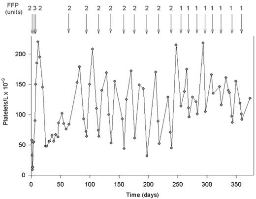 Figure 4. The effect of fresh frozen plasma (FFP) infusions on the platelet count in a patient with severe constitutional deficiency of von Willebrand factor (VWF)-cleaving protease. / This patient had no acute episode of thrombotic thrombocytopenic purpura (TTP) before age 20. The first TTP event was followed by several acute bouts, leading to a diagnosis of chronic relapsing TTP caused by severe VWF-cleaving protease deficiency. After the last relapse at age 36, the patient received 8 months of prophylactic treatment with 2 units of FFP every third week, and subsequently with only 1 unit of FFP every 2 weeks. / Reprinted with permission from Furlan M, Lämmle B. Best Pract Res Clin Haematol. 2001;14:437-454.