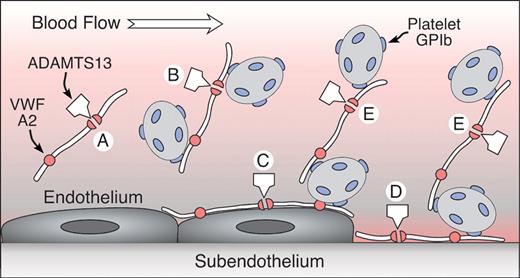 Sadler Figure 2 (in George et al). A model for the role of UL-VWF and ADAMTS13 in TTP. / UL-VWF is released from endothelial cells that enter the circulation (A,B) or adhere to the endothelial surface (C). VWF also binds to exposed connective tissue at sites of injury (D). Platelets adhere to VWF in solution (B) or on surfaces (C,D) through platelet glycoprotein Ib (GPIb). VWF also may recruit platelets to previously adhering platelets (E). ADAMTS13 cleaves the A2 domain of the VWF subunit, severing the multimer. This reaction is slow for VWF in solution (A) but occurs rapidly when platelets adhere to VWF under high fluid shear conditions in suspension (B) or on surfaces (C,D,E), presumably as a consequence of conformational changes induced by tensile force on the VWF multimer. Failure of this mechanism appears to cause TTP. / Adapted with permission from Sadler JE: A new name in thrombosis, ADAMTS13. Proc Natl Acad Sci USA 2002;99:11552-11554 (Copyright 2002 National Academy of Sciences, U.S.A.).
