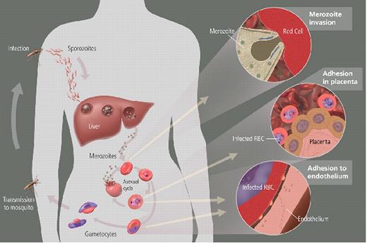 Miller Figure 2 (in Weatherall et al). Parasite life cycle and pathogenesis of falciparum malaria. / The molecular and cellular events during the life cycle influence disease severity. Disease only occurs as a result of the asexual blood stage after the parasite leaves the liver and begins to invade and grow inside red cells (RBCs). All human Plasmodium spp. invade by the same mechanism, but P. falciparum reaches high parasitemia because of greater flexibility in receptor pathways that it can use to invade all RBCs. RBCs infected with P. falciparum must bind to endothelium or placenta for the parasite to avoid spleen-dependent killing mechanisms, but this binding also leads to much of the pathology (see Miller Figure 3).