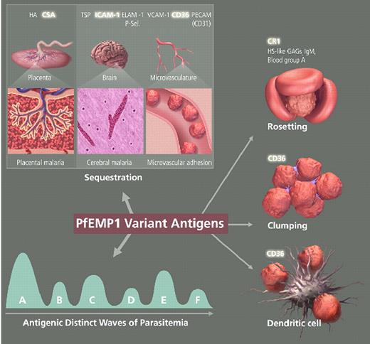 Miller Figure 3 (in Weatherall et al). The variant antigen family of PfEMP1 is central to host-parasite interaction and pathogenesis. / PfEMP1 expressed on the surface of mature P. falciparum-infected RBCs is involved with clonal antigenic variation and can bind to many host receptors through its multiple adhesion domains. The different properties of PfEMP1sequestration for evading spleen-dependent killing and antigenic variation for evasion of antibody-dependent killingcontribute to the virulence and pathogenesis of P. falciparum and are essential for the survival of the parasite. Parasite sequestration in the brain and placenta contribute to the complications of cerebral malaria and placental malaria, respectively. Simultaneous binding to several receptors, binding of uninfected erythrocytes (rosetting), and clumping of infected erythrocytes through platelets are associated with malaria pathogenesis. Parasite-infected RBCs binding to dendritic cells downregulate the host immune response. / Abbreviations: HA, hyaluronic acid; TSP, thrombospondin; ELAM-1, endothelial/leukocyte adhesion molecule 1; P-sel., P-selectin; VCAM-1, vascular cell adhesion molecule 1; CR1 complement receptor 1; HS-like GAGs, heparin sulfate-like glycosaminoglycans; IgM, immunoglobulin M.