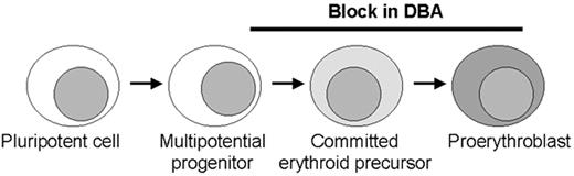 Figure 3. Model of erythroid production with possible sites of blockage (black bar) in Diamond-Blackfan anemia (DBA) along the pathway from early commitment and proliferation. / Most patients have no or very few recognizable erythroid elements whereas some patients retain a relatively normal number of erythroid precursors with an arrest at the proerythroblast stage. These stages in erythroid development require different molecules, including transcription factors and proteins in the EPO signalling pathway that may be involved in the pathogenesis of DBA. The role for ribosomal protein S19 at the stages of blockage is unclear.