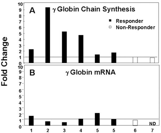 Figure 2. γ-Globin response in seven sickle cell disease patients. / (▪) Butyrate responsive patients. (□) Butyrate nonresponsive patients. / A: γ-globin chain synthesis; B: γ-globin mRNA.