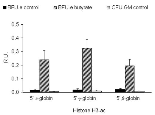 Figure 5. Butyrate-induced changes in histone H3 acetylation in sickle cell disease. / A: Acetylation of histone H3 in BFU-E or CFU-GM derived cells from a patient with sickle cell disease. The bar graph shows the results of ChIP analysis of the promoters of the ε-, γ-, and β-globin genes expressed as relative units (RU). / B: mRNA levels of different globins measured by real-time PCR and expressed as fold change between control BFU-E cells and butyrate exposed BFU-E cells. / C: mRNA levels of different globins measured by real-time PCR and expressed as ratios in control BFU-E cells and butyrate exposed BFU-E cells.