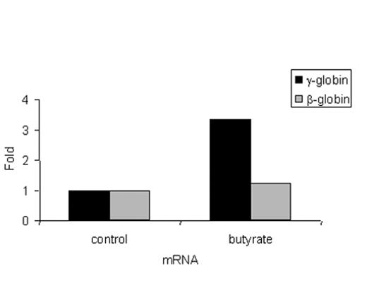 Figure 5. Butyrate-induced changes in histone H3 acetylation in sickle cell disease. / A: Acetylation of histone H3 in BFU-E or CFU-GM derived cells from a patient with sickle cell disease. The bar graph shows the results of ChIP analysis of the promoters of the ε-, γ-, and β-globin genes expressed as relative units (RU). / B: mRNA levels of different globins measured by real-time PCR and expressed as fold change between control BFU-E cells and butyrate exposed BFU-E cells. / C: mRNA levels of different globins measured by real-time PCR and expressed as ratios in control BFU-E cells and butyrate exposed BFU-E cells.