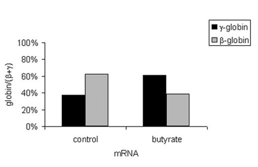 Figure 5. Butyrate-induced changes in histone H3 acetylation in sickle cell disease. / A: Acetylation of histone H3 in BFU-E or CFU-GM derived cells from a patient with sickle cell disease. The bar graph shows the results of ChIP analysis of the promoters of the ε-, γ-, and β-globin genes expressed as relative units (RU). / B: mRNA levels of different globins measured by real-time PCR and expressed as fold change between control BFU-E cells and butyrate exposed BFU-E cells. / C: mRNA levels of different globins measured by real-time PCR and expressed as ratios in control BFU-E cells and butyrate exposed BFU-E cells.