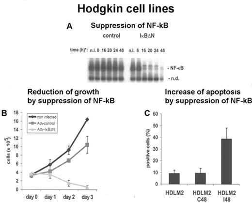 Figure 7. Adenovirus-mediated IκBΔN expression abrogates NF-κB activity and induces massive spontaneous apoptosis in HDLM2 cells. / (A) Whole cell extracts of HDLM2 cells infected with Ad5 control or Ad5-IκBΔN were analyzed by EMSA using an H2K binding site probe; (B) growth rates of uninfected or infected HDLM2 cells, as indicated, were determined in 5 independent experiments; and (C) apoptotic cells were determined by annexin V staining in uninfected or infected cells. / Abbreviations: N, novel NF-κB target genes. / Reprinted with permission from Hinz M, Lemke P, Anagnostopoulos I, et al. Nuclear factor kappaB-dependent gene expression profiling of Hodgkin’s disease tumor cells, pathogenetic significance, and link to constitutive signal transducer and activator of transcription 5a activity. J Exp Med. 2002;196:605–617. by copyright permission of The Rockefeller University Press.