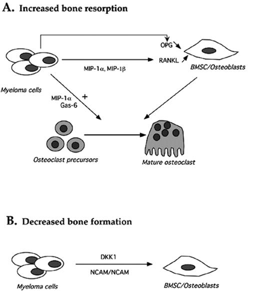 Figure 3. Biological mechanisms involved in the excessive bone resorption in multiple myeloma (MM). / (A) MM tumor induces enhanced osteoclast differentiation and activity directly and through stromal cells/osteoblasts and (B) decreases bone formation.