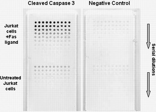 Figure 6. Application of protein arrays to apoptotic signaling pathways.Jurkat cells were treated with Fas ligand to induce apoptosis. Arrays were printed using cell lysates in serial dilutions and probed using an antibody specific to the cleaved (active) form of caspase 3. Increased cleaved caspase 3 is noted in the Fas ligand–treated cells (upper left). Hundreds of replicate arrays can be printed and probed with other antibodies; arrays then can be scanned, quantified, and compared.