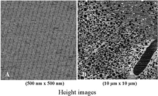 Figure 7. Annexin A5—effect of aPL antibody. / (A) An atomic force image of the 2-dimensional crystallization of annexin A5 over a phospholipid bilayer. Each of the circular structures that compose each row is a trimer of annexin A5. The crystal covers nearly 100% of the phospholipid bilayer. / (B) The effects of a monoclonal aPL antibody together with β2GPI on the crystal structure of annexin A5. The aPL-β2GPI results in marked disruptions of the annexin A5 crystal. / Abbreviations: aPL, antiphospholipid; β2GPI, β2-glycoprotein I.