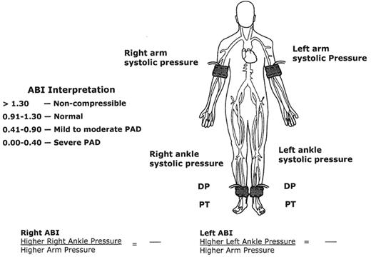 Figure 2. Measurement of the Ankle/Brachial Index.