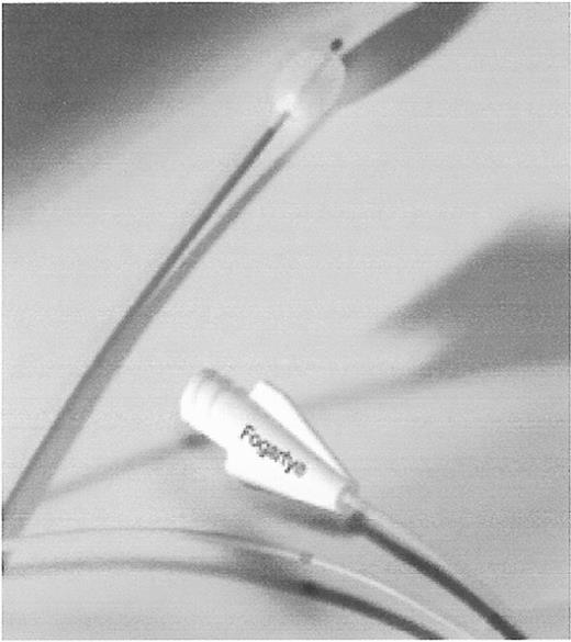 Figure 3. Fogarty balloon catheter.