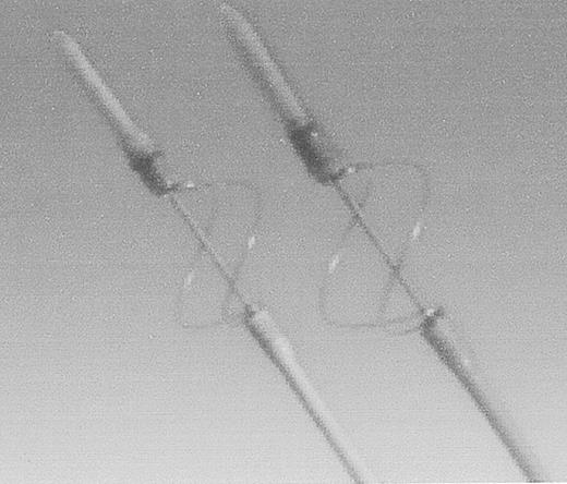 Figure 5. Fogarty Graft Thrombectomy Catheter. / Bare metal loops remove tenacious, prosthetic graft-bound thrombus. Not to be used in native arteries.