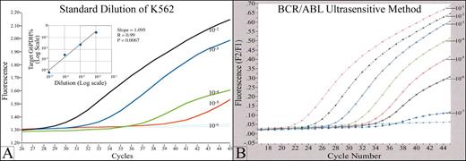 Braziel Figure 1. An example of a real time quantitative fluorescence RT-PCR assay (Q-RT-PCR) for detection of minimal residual disease (MRD) in chronic myelogenous leukemia (CML). / (A) The graph shows a typical standard curve, generated by Q-RT-PCR of a series of serial dilutions of a BCR/ABL (+) cell line. BCR/ABL transcripts in RNA from clinical samples are quantitated by comparison to this standard curve. p210 and p190 BCR/ABL transcripts, in both cell line standards and patient samples, are normalized to G6PDH housekeeping gene. The fluorescence signal generated during the PCR process is proportional to the starting quantity of BCR/ABL template, and is detected by a fluorimeter in the instrument. The PCR reaction is monitored in real time, during the geometric phase of the reaction; data from the linear and plateau phases are not used. The standard test will detect 1 BCR/ABL (+) cell in 105 normal cells. (B) Increased analytical sensitivity of 1 (+) cell in 106-7 normal cells can be obtained by concentration of sample RNA used in the analysis.