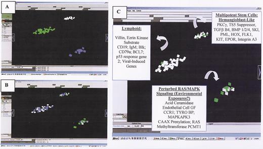 Willman Figure 8. (in Carroll et al) . A. Three intrinsic biologic clusters of infants were distinguished by VxInsight and through PCA (not shown). In each cluster, each individual patient is represented by a pyramid. B. Each case was queried for the presence of ALL (white pyramids) vs. AML (green pyramids) morphology (appreciated better in Figure 1C, to the right) and the presence of chromosomal rearrangements involving the MLL gene (shown as blue pyramids). C. ANOVA was used to identify the most statistically significant genes that were unique to each cluster and which could be used to distinguish each cluster.