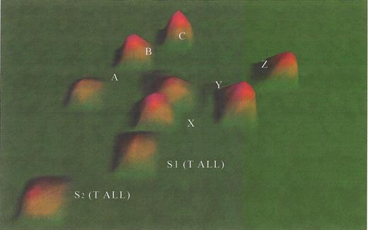 Willman Figure 9. (in Carroll et al). VxInsight: ALL.