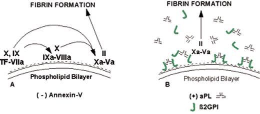 Rand Figure 8. (in Warkentin et al). Mechanism of lupus anticoagulant effect—role as surrogate marker. / (A) Anionic phospholipids, predominantly phosphatidylserine (negative charges), serve as potent cofactors for the assembly of 3 different coagulation complexes—the TF-VIIa complex, the IXa-VIIIa complex, and the Xa-Va complex—and thereby accelerate blood coagulation. The TF complex yields factors IXa or factor Xa; the IXa complex yields factor Xa; and the Xa formed from both of these reactions is the active enzyme in the prothrombinase complex that yields factor IIa (thrombin), which in turn cleaves fibrinogen to form fibrin. / (B) Lupus anticoagulant effect. aPL antibody-β2GPI complexes can prolong the coagulation times, compared with control antibodies, when there are limiting quantities of anionic phospholipid available. This effect occurs via antibody recognition of domains I or II on the β2GPI, which results in dimeric and pentameric IgG- and IgM-β2GPI complexes (such as the IgG antibody-β2GPI complexes shown) having high affinity for phospholipid via the cofactor’s domain V. These high-affinity complexes reduce the access of coagulation factors to anionic phospholipids, thereby resulting in a “lupus anticoagulant” effect in conditions where the antibody-cofactor complexes have sufficiently high affinity. / (C) Annexin A5, in the absence of aPL antibodies, serves as a potent anticoagulant by crystallizing over the anionic phospholipid surface, shielding it from availability to bind coagulation proteins. / (D) aPL antibody-mediated disruption of annexin A5 shield. aPL-β2GPI complexes with high affinity for phospholipid membranes disrupt the ability of annexin A5 to form ordered crystals on the phospholipid surface. This defective crystallization results in a net increase of the amount of anionic phospholipid available for promoting coagulation reactions. / Abbreviations: aPL, antiphospholipid; β2GPI, β2-glycoprotein I; TF, tissue factor.