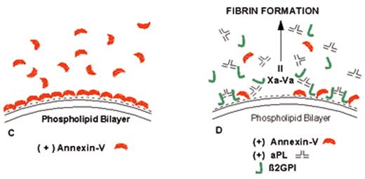 Rand Figure 8. (in Warkentin et al). Mechanism of lupus anticoagulant effect—role as surrogate marker. / (A) Anionic phospholipids, predominantly phosphatidylserine (negative charges), serve as potent cofactors for the assembly of 3 different coagulation complexes—the TF-VIIa complex, the IXa-VIIIa complex, and the Xa-Va complex—and thereby accelerate blood coagulation. The TF complex yields factors IXa or factor Xa; the IXa complex yields factor Xa; and the Xa formed from both of these reactions is the active enzyme in the prothrombinase complex that yields factor IIa (thrombin), which in turn cleaves fibrinogen to form fibrin. / (B) Lupus anticoagulant effect. aPL antibody-β2GPI complexes can prolong the coagulation times, compared with control antibodies, when there are limiting quantities of anionic phospholipid available. This effect occurs via antibody recognition of domains I or II on the β2GPI, which results in dimeric and pentameric IgG- and IgM-β2GPI complexes (such as the IgG antibody-β2GPI complexes shown) having high affinity for phospholipid via the cofactor’s domain V. These high-affinity complexes reduce the access of coagulation factors to anionic phospholipids, thereby resulting in a “lupus anticoagulant” effect in conditions where the antibody-cofactor complexes have sufficiently high affinity. / (C) Annexin A5, in the absence of aPL antibodies, serves as a potent anticoagulant by crystallizing over the anionic phospholipid surface, shielding it from availability to bind coagulation proteins. / (D) aPL antibody-mediated disruption of annexin A5 shield. aPL-β2GPI complexes with high affinity for phospholipid membranes disrupt the ability of annexin A5 to form ordered crystals on the phospholipid surface. This defective crystallization results in a net increase of the amount of anionic phospholipid available for promoting coagulation reactions. / Abbreviations: aPL, antiphospholipid; β2GPI, β2-glycoprotein I; TF, tissue factor.