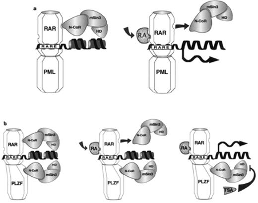 Figure 2. A model for the interactions of APL fusion proteins with the N-Co-R-mSin3-histone deacetylase complex.Reprinted with permission from Grignani F, De Matteis S, Nervi C, et al. Fusion proteins of the retinoic acid receptor-alpha recruit histone deacetylase in promyelocytic leukemia. Nature. 1998;391:815–818.