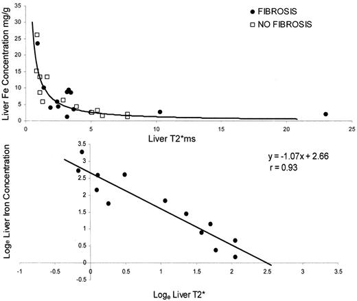 Figure 2. Validation of T2* as a measure of tissue iron. . / The upper graph shows the relation between liver iron from liver biopsy, and liver T2* measured by MR. The curvilinear relation becomes linear on the lower graph by using a log-log plot (non-fibrotic samples). This confirms that tissue iron affects tissue T2* and provides a calibration curve for liver T2*. Calibration of myocardial T2* is not yet available, but there is no doubt that myocardial T2* can be used to quantify relative myocardial iron levels. / Reproduced with permission from Anderson LJ, Holden S, Davies B, et al. Cardiovascular T2* (T2 star) magnetic resonance for the early diagnosis of myocardial iron overload. Eur Heart J. 2001;22:2171–2179.