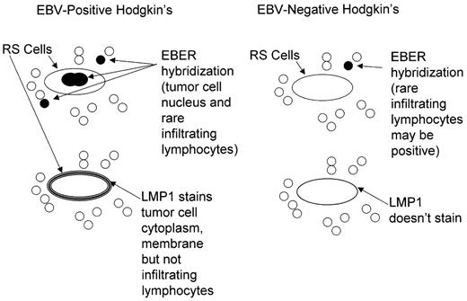 Figure 2. Detection of Epstein-Barr virus (EBV) in clinical specimens.