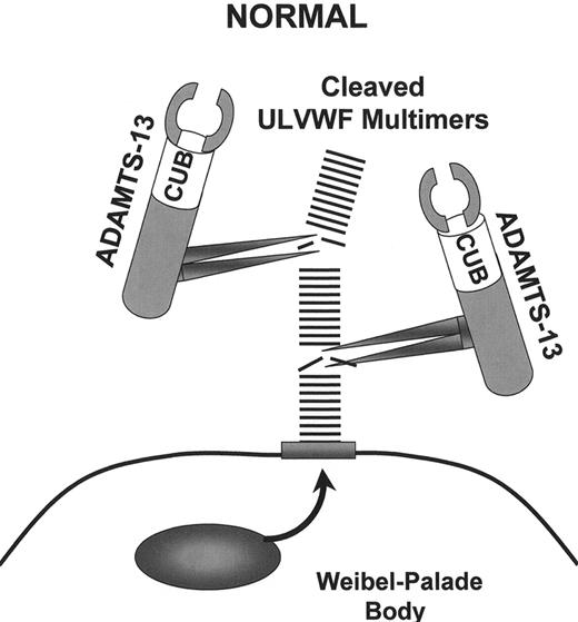 Figure 2. ADAMTS13 activity in normal and thrombotic thrombocytopenia purpura (TTP) plasma. / (A) In normal individuals, ADAMTS13 enzyme molecules from the plasma attach to, and then cleave, unusually large von Willebrand factor (ULVWF) multimers that are secreted in long “strings” from stimulated endothelial cells. / (B) The ULVWF multimeric strings may be anchored in the endothelial cell membrane to P-selectin molecules that are secreted concurrently with the ULVWF multimers from Weibel-Palade bodies. P-selectin molecules are retained in the endothelial cell membrane by a transmembrane portion. Each ADAMTS13 molecule may dock via one or both of its C-terminal CUB domains, possibly along with one or more thrombospondin-1-like domains, to exposed A3 domains in ULVWF monomeric subunits. The attached ADAMTS13 molecules then cleave Tyr 842–843 Met peptide bonds in the adjacent A2 domains of ULVWF monomeric subunits. The smaller VWF forms that circulate after cleavage do not induce the adhesion and aggregation of platelets during normal blood flow. / (C) Absent or severely reduced activity of ADAMTS13 in patients with TTP prevents the timely cleavage of ULVWF multimers secreted by endothelial cells. Uncleaved ULVWF multimers induce the adhesion and subsequent aggregation of platelets in flowing blood. Congenital deficiencies of ADAMTS13 activity caused by gene mutations or acquired defects of ADAMTS13 caused by autoantibodies result in TTP.